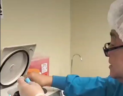 PRP - microneedling